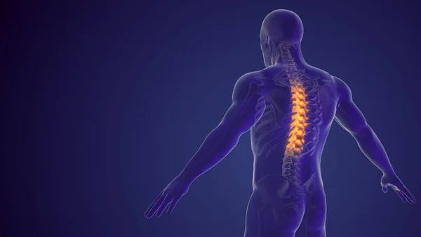 脊髄痛または腰痛医学的背景 — ストック写真