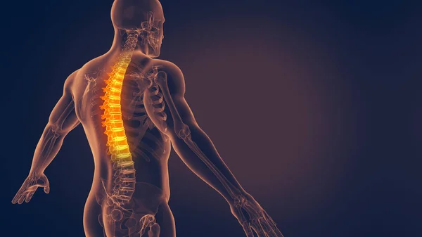 人类脊柱疼痛3D图解 — 图库照片