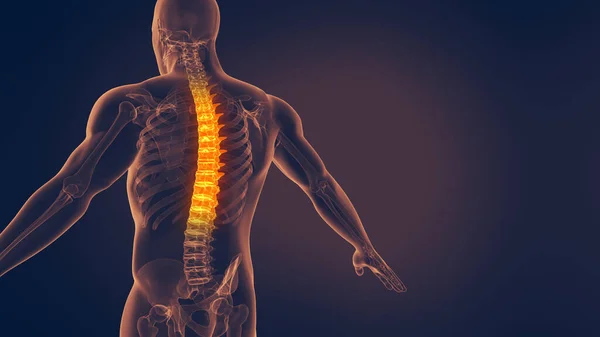 人間の脊髄痛3Dイラスト — ストック写真