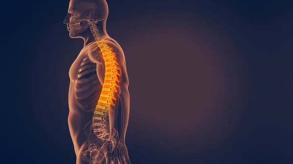人类脊柱疼痛3D图解 — 图库照片
