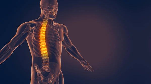 人間の脊髄痛3Dイラスト — ストック写真