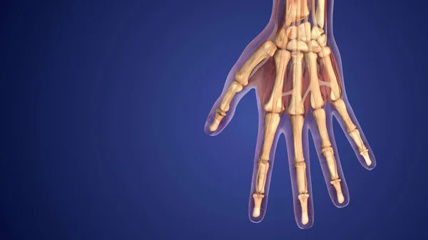 Otoimmün Iltihaplı Hastalık Veya Romatoid Artrit — Stok fotoğraf