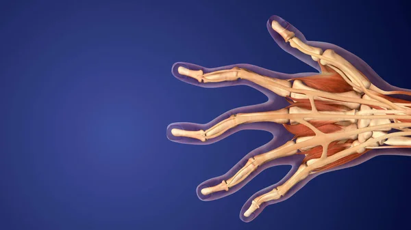 Romatoid Artrit Otoimmün Iltihaplı Bir Hastalıktır — Stok fotoğraf