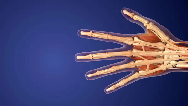 Reumatoïde Artritis Een Auto Immuun Ontstekingsziekte — Stockfoto