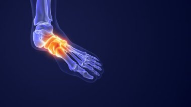 Ağrıyan ayaklar ve düşen kemerler yüzünden