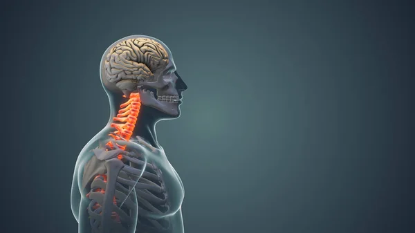颈部疼痛或颈部姿势综合征医学动画 — 图库照片
