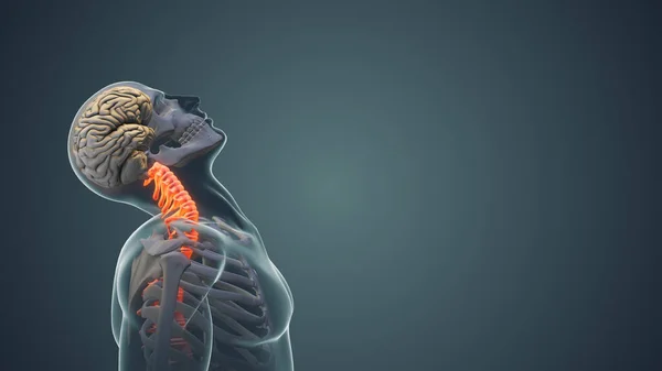 Douleur Cou Syndrome Posture Cervicale Animation Médicale — Photo