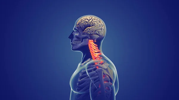Douleur Cou Syndrome Posture Cervicale — Photo