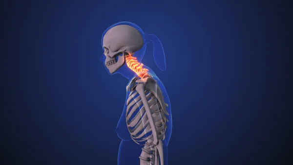 Douleur Cou Dysfonctionnement Cou Syndrome Posture Cervicale — Photo