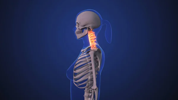 Douleur Cou Dysfonctionnement Cou Syndrome Posture Cervicale — Photo