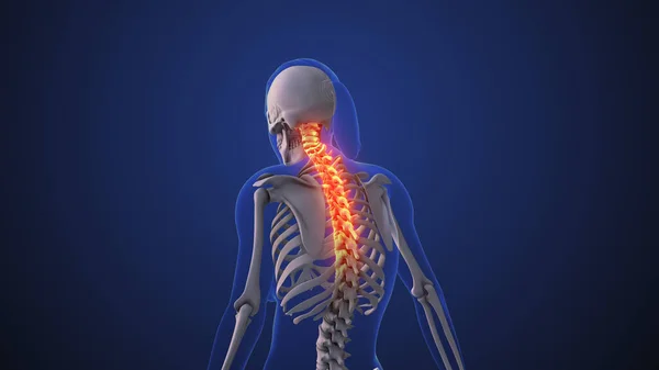 颈部疼痛或颈部功能障碍 — 图库照片