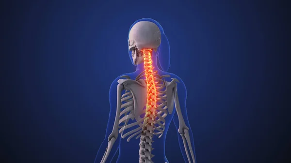 颈部疼痛或颈部功能障碍 — 图库照片