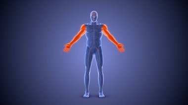 Diplegia felç durumu tıbbi konsepti