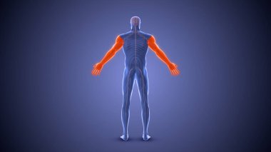 Diplegia felç durumu tıbbi konsepti