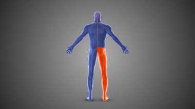 Çeşitli felç durumlarının tıbbi konsepti