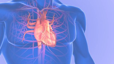 İnsan kalbinde tıkanmış arterler ya da atherosclerosis.