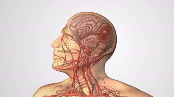 缺血性中风或脑血管疾病 — 图库视频影像
