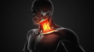 Sternokleidomastoid kaslarda ağrı ve yaralanma