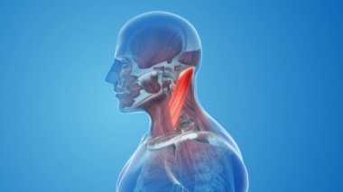 Sternokleidomastoid Kas ağrısı ve yaralanma