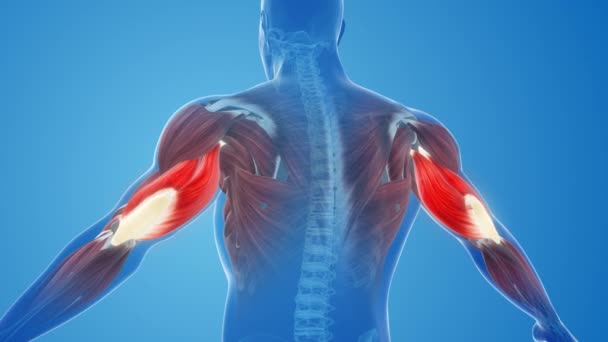 Triceps Μυϊκός Πόνος Και Τραυματισμό — Αρχείο Βίντεο