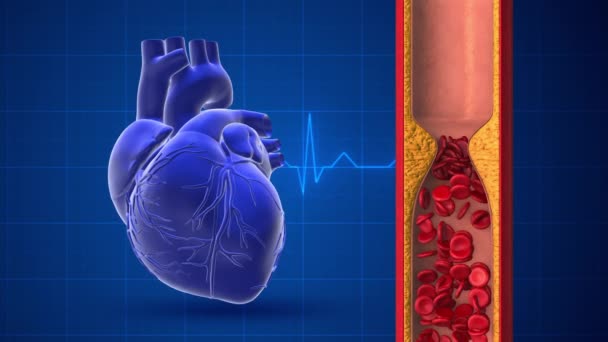 Coração Humano Com Bloqueio Arterial Traço Pulso — Vídeo de Stock