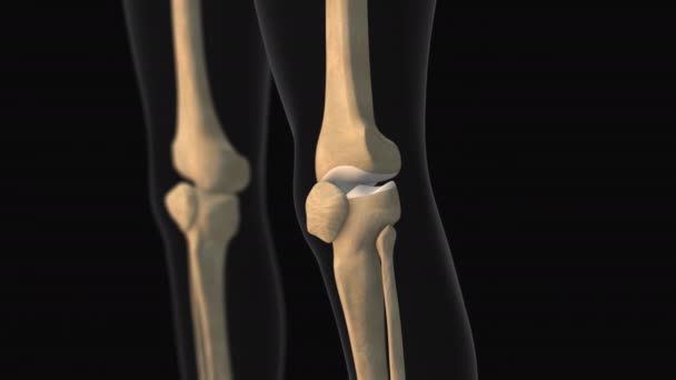 膝痛のメディカルアニメーション — ストック動画