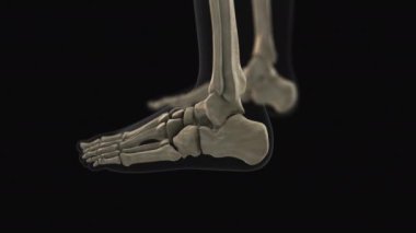 Calcaneus kemik ağrısının tıbbi animasyonu.