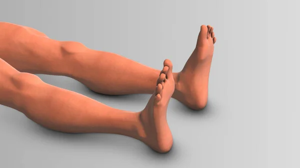 Lower limb edema or swollen legs