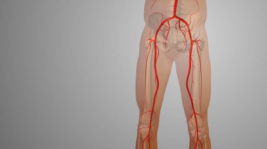 Peripheral artery bypass surgery medical animation clipart