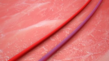 Varisli damarların tıbbi animasyonu.