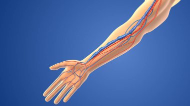Arteriovenöz fistülün tıbbi animasyonu.