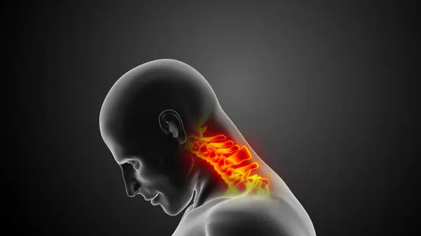 Cervical spine or neck injuries