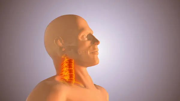 Neck or cervical spine injuries