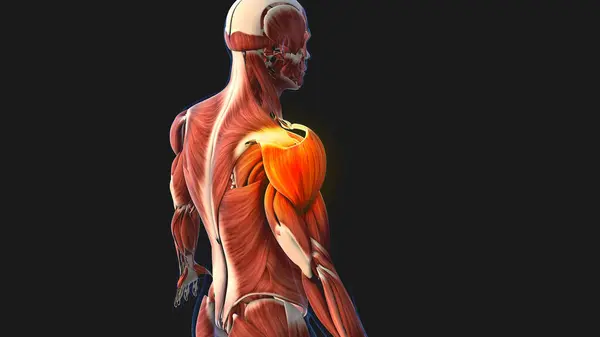 Douleurs Musculaires Blessures Aux Épaules Animation Médicale — Photo