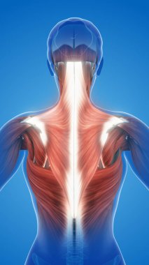 Trapezius kaslarında ağrı ve hasar