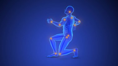 Çoklu eklemlerdeki kronik ağrı genellikle osteoartrite (romatoid artrit gibi) ya da çocuklarda juvenile idiyopatik artrite bağlı olarak görülür..