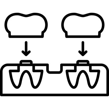Diş implantı simgesi, dış hat biçimi