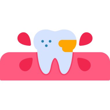 Diş implantı olan dişler. Beyaz arkaplanda izole edilmiş vektör illüstrasyonu