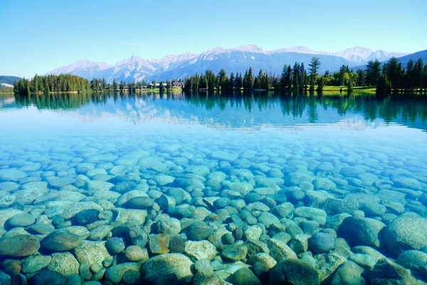 Eaux Bleues Transparentes Verglacées Lac Beauvert Près Jasper Dans Les — Photo