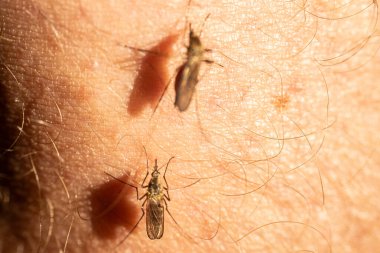 İnsan derisindeki sivrisineğin detaylı makro görüntüsü böceğin karmaşık vücut yapısını ve ince kıllarını vurguluyor. Görüntü sivrisineğin deriyle olan etkileşimini vurgular, kanatlarını gösterir ve...