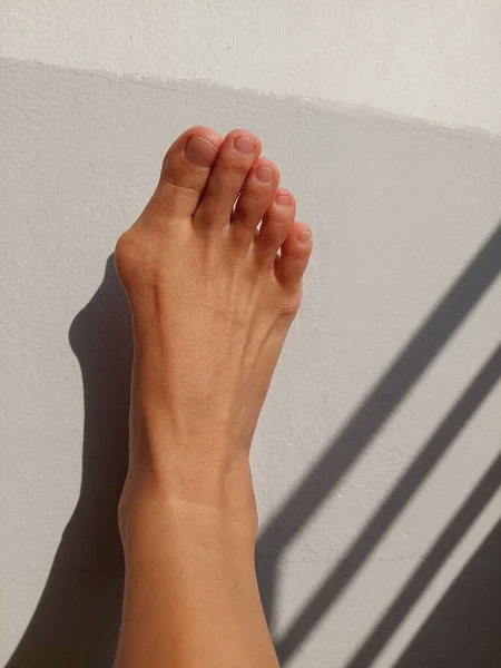 Woman Right Foot Hallux Valgus Foot Bunions Bony Bump — Stock Photo, Image