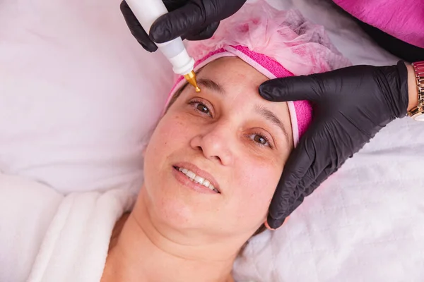 美しい大人の女性 治療のための顔の放射線周波数の適用 — ストック写真