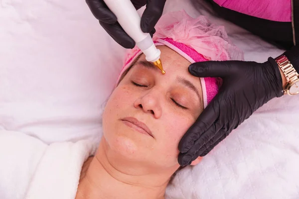 美しい大人の女性 治療のための顔の放射線周波数の適用 — ストック写真