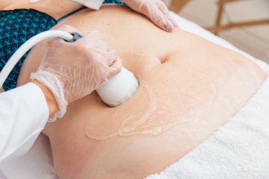 Estetik klinik, ultrason fotoğrafı, radyofrekans, zayıflatma..