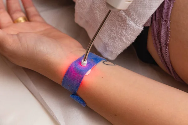 Treatment Using Ilib Wrist Brace — Stock Photo, Image