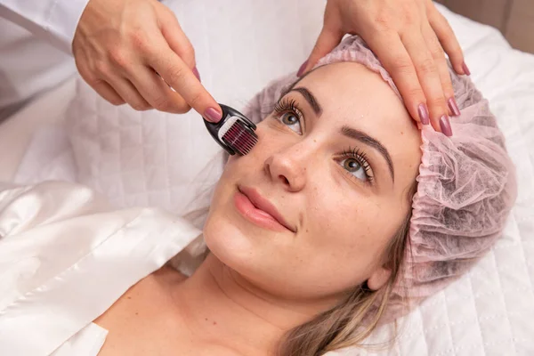 Close Weibliches Gesicht Mit Dermaroller Für Mesotherapie Verfahren Hautpflege Hause — Stockfoto