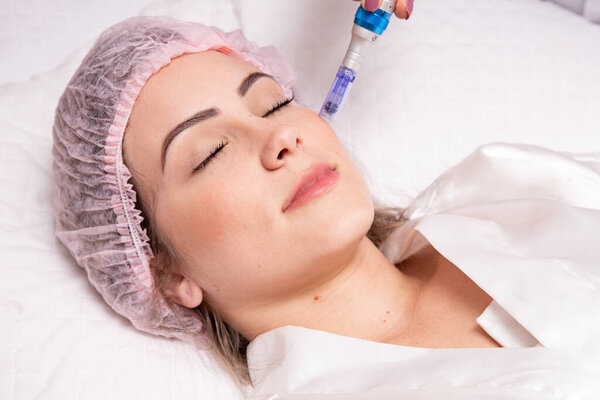 Beautiful woman receiving microneedling rejuvenation treatment. Mesotherapy.