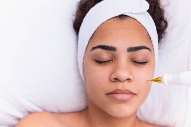 Kadın güzellik kliniğinde plazma jetiyle yüz bakımı yapıyor..