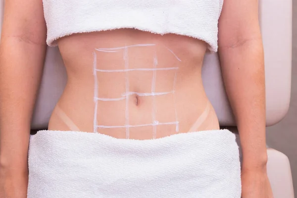 Bir kadının göbeğinin yakın plan fotoğrafı, estetik fotoğrafı, karnındaki prosedürler. Güzellik kliniği. Ozon uygulaması, ozon terapisi, enzimler, inceltme. kilo kaybı.