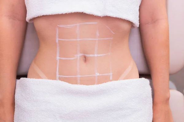 女性の腹のクローズアップ写真美の写真腹部の手順 美容クリニック オゾンの応用オゾン療法酵素痩身 体重減少 — ストック写真